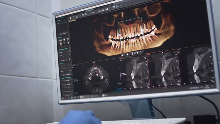 Dental X-Rays and Imaging in Middletown, OH