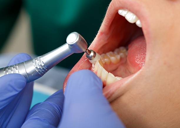 Best Tooth Extraction  in Middletown, OH